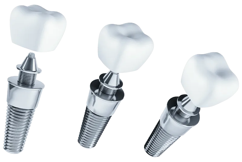 implants
