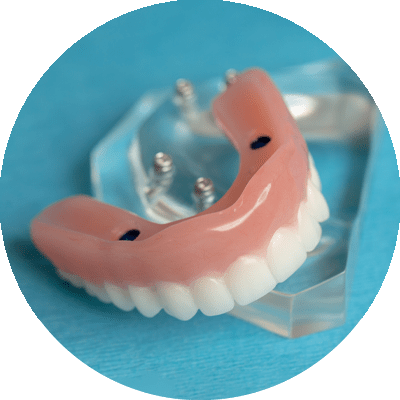 snap on denture on teal counter