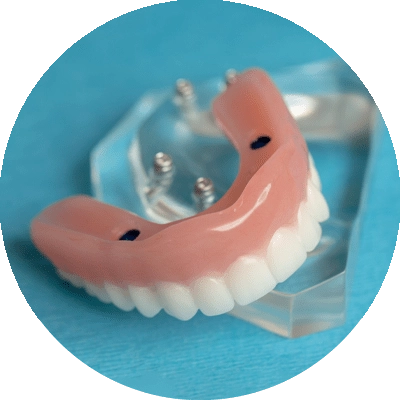 snap on denture on teal counter