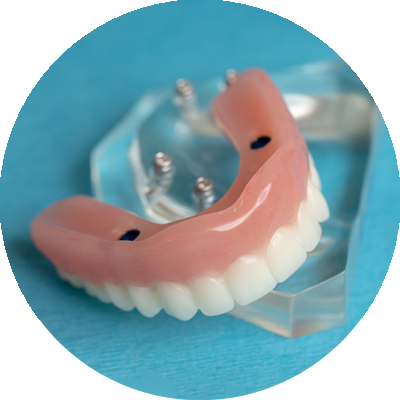 snap on denture on teal counter