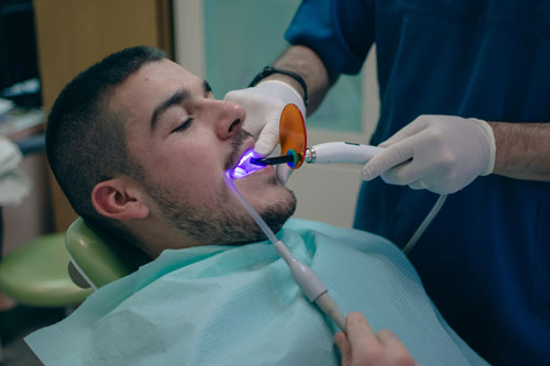 Bonding dental fillings with a UV lamp